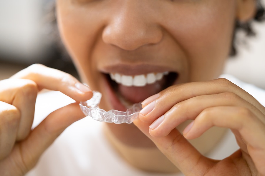 Unlocking Your Smile Potential: A Deep Dive into the Benefits of Invisalign Treatment