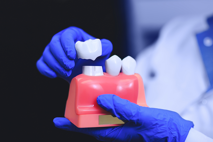 Enhancing Your Smile with Dental Crowns in Englishtown, NJ