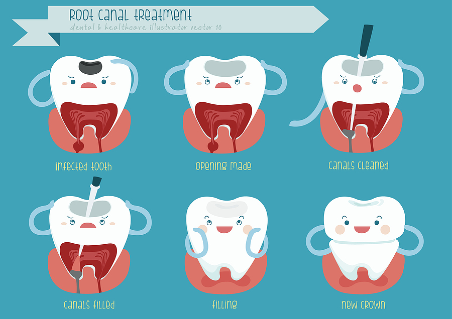 Everything You Need to Know About Root Canal Treatment in Englishtown, NJ